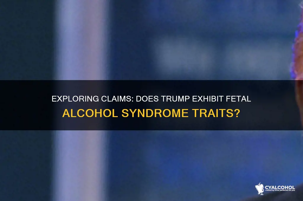 does trump have fetal alcohol syndrome