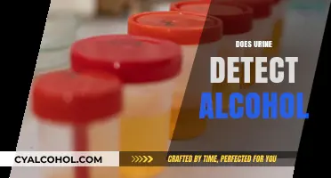 Can Urine Tests Accurately Detect Alcohol Consumption? Find Out Here