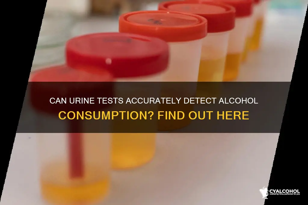 does urine detect alcohol