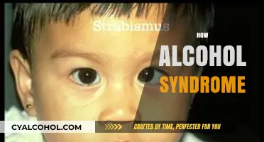 Understanding Fetal Alcohol Syndrome: Causes, Effects, and Prevention Strategies