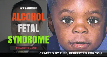Understanding Fetal Alcohol Syndrome: Prevalence and Prevention Strategies