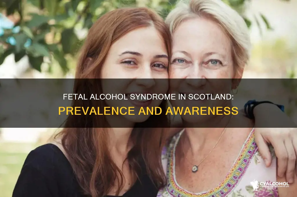 how common is fetal alcohol syndrome in scotland