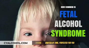Understanding Fetal Alcohol Syndrome: Prevalence, Risks, and Prevention Tips