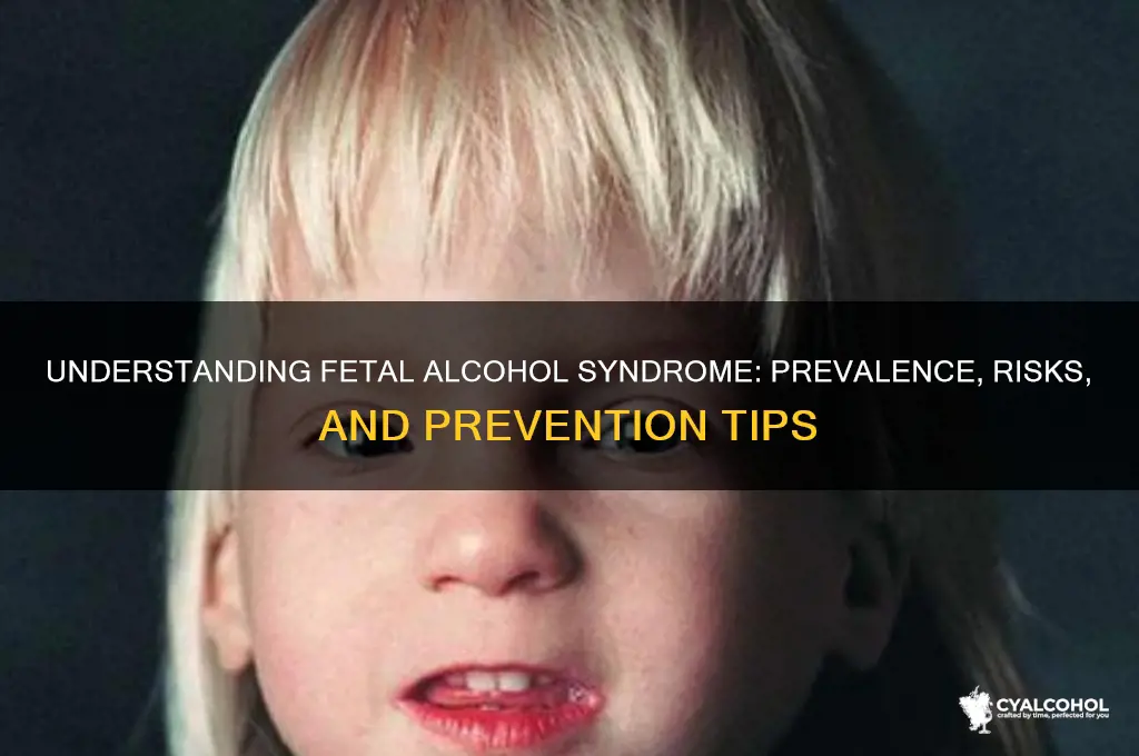 how common is fetal alcohol syndrome
