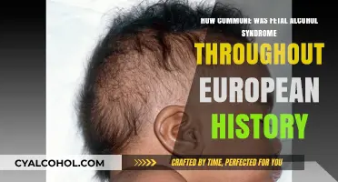 European History: Alcohol Syndrome's Common Fate