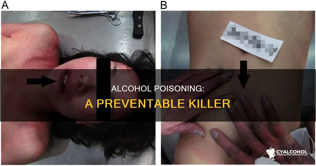 how do you die of alcohol poisoning every year