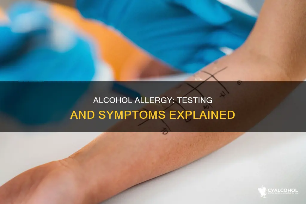 how do you find out if your allergic to alcohol
