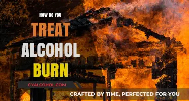 Treating Alcohol Burns: Effective Remedies and First Aid Tips