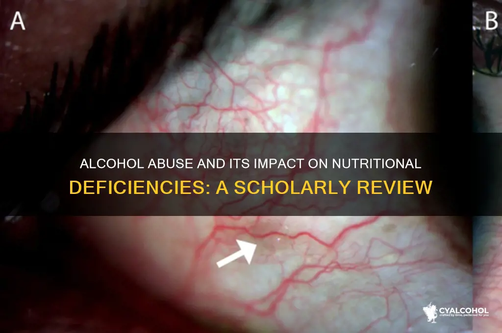 how does alcohol abuse impaired nutritional status scholarly