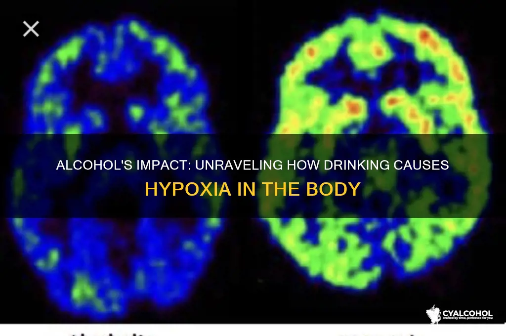 how does alcohol lead to hypoxia
