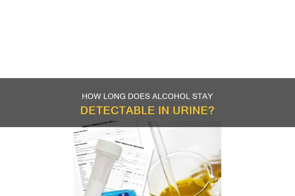 how does alcohol stay in urine