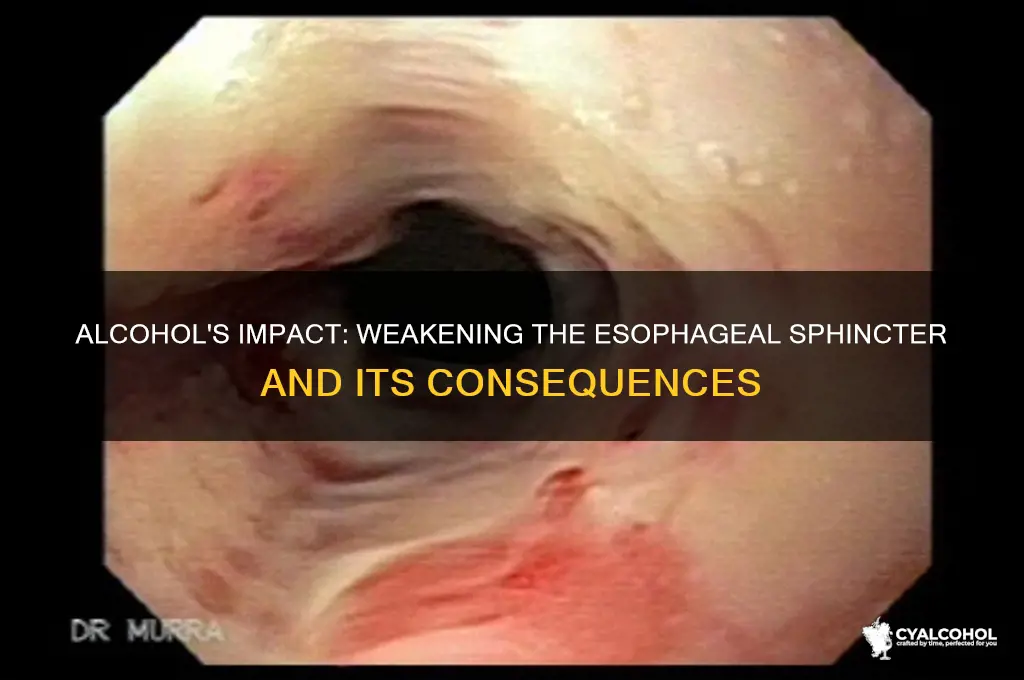 how does alcohol weaken esophageal sphincter
