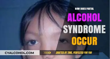 Understanding Foetal Alcohol Syndrome: Causes, Risks, and Prevention Strategies