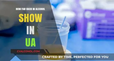 How Long Does Alcohol Stay Detectable in Urine Tests?