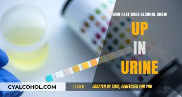 How Quickly Does Alcohol Appear in Urine Tests?