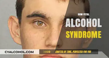 Understanding Fetal Alcohol Syndrome: Causes, Effects, and Prevention Strategies