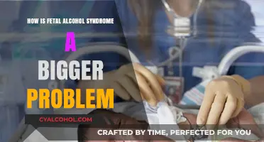 Fetal Alcohol Syndrome: A Growing, Often Overlooked Public Health Crisis