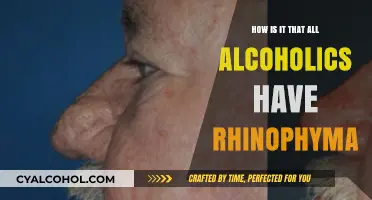 Rhinophyma and Alcoholism: Unraveling the Surprising Skin Connection