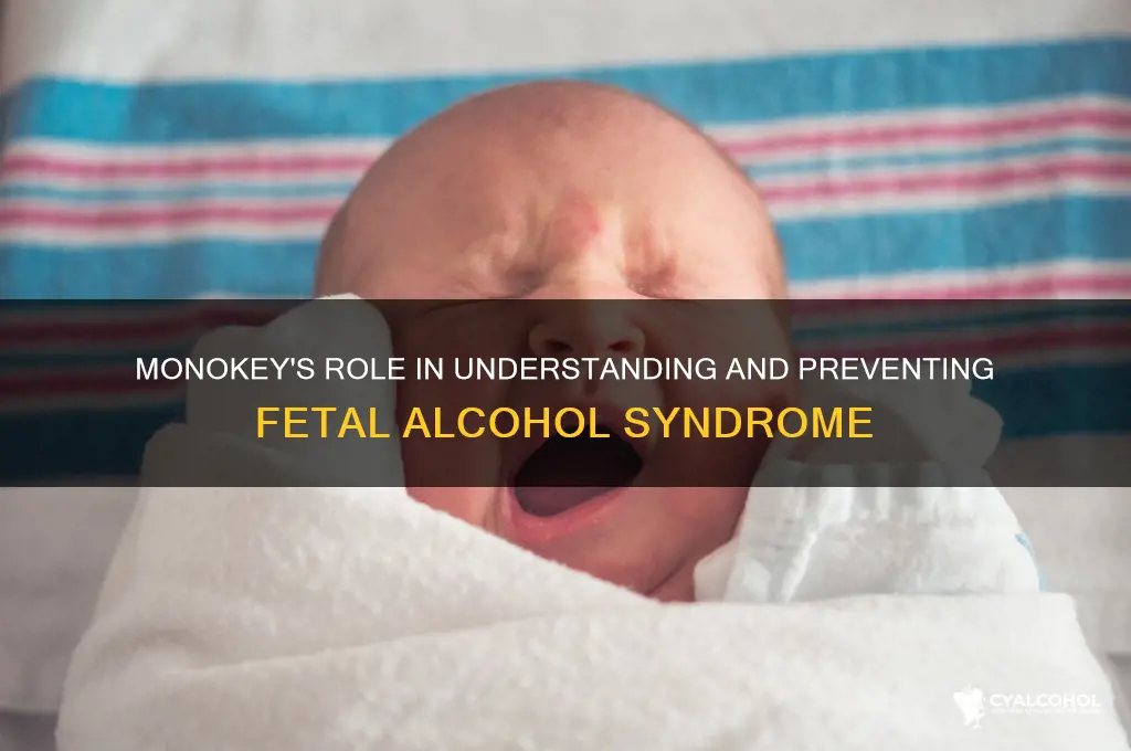 how is monokey related to fetal alcohol syndrome