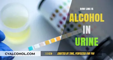How Long Does Alcohol Stay Detectable in Your Urine?