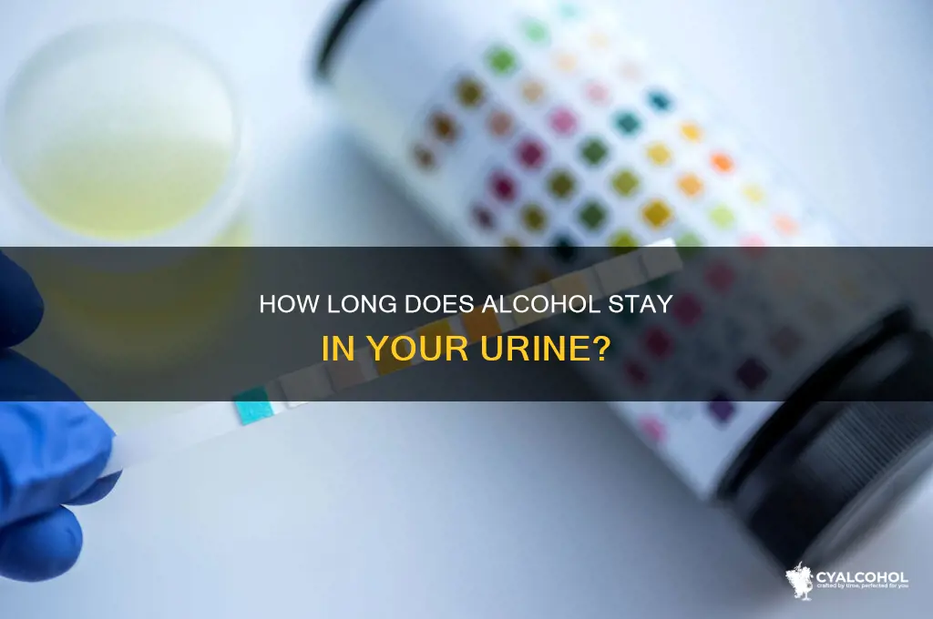 how lomg does alcohol stay in your urine