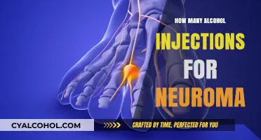 Alcohol Injections for Neuroma: Treatment Frequency and Effectiveness Explained