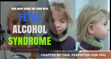 Fetal Alcohol Syndrome: Babies Born with Brain Damage