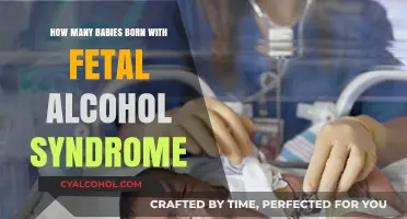 Understanding Fetal Alcohol Syndrome: Birth Rates and Prevention Strategies