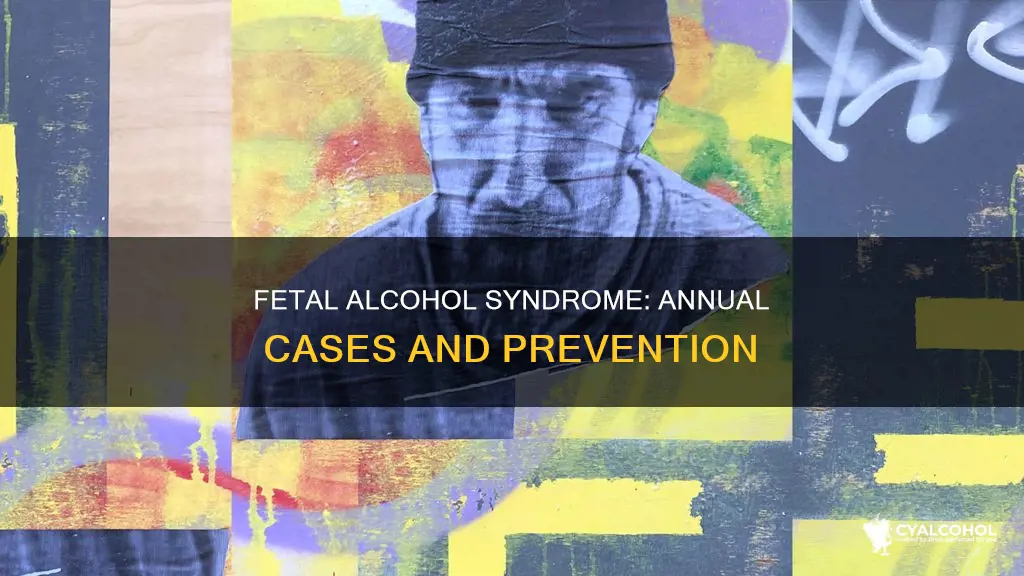 how many cases of fetal alcohol syndrome a year
