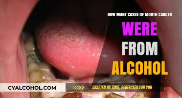 Alcohol-Related Mouth Cancer Cases: A Startling Number