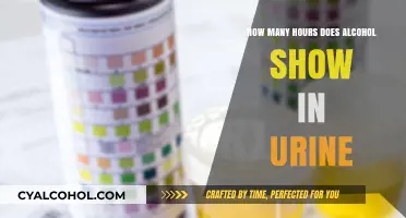 Detecting Alcohol in Urine: How Long Does It Show Up?