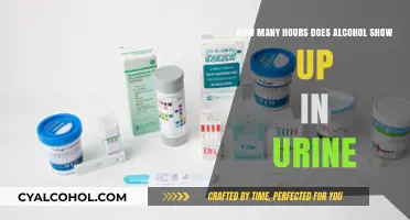 Alcohol in Urine: Detectable Hours After Consumption