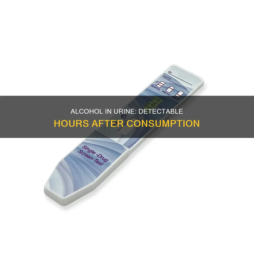 how many hours does alcohol show up in urine