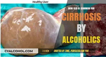 Understanding the Typical Age of Alcohol-Related Cirrhosis Diagnosis
