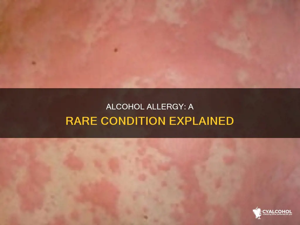how rare is it to be allergic to alcohol