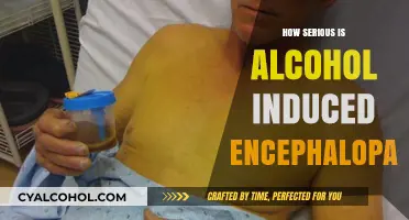 Alcohol-Induced Encephalopathy: Understanding the Severity and Long-Term Risks