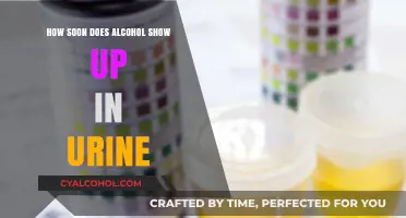Alcohol Detection in Urine: How Soon?