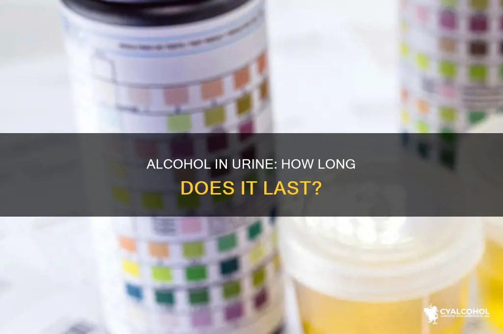 how soon is alcohol out of your urine