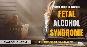 Caring for a Baby with Fetal Alcohol Syndrome