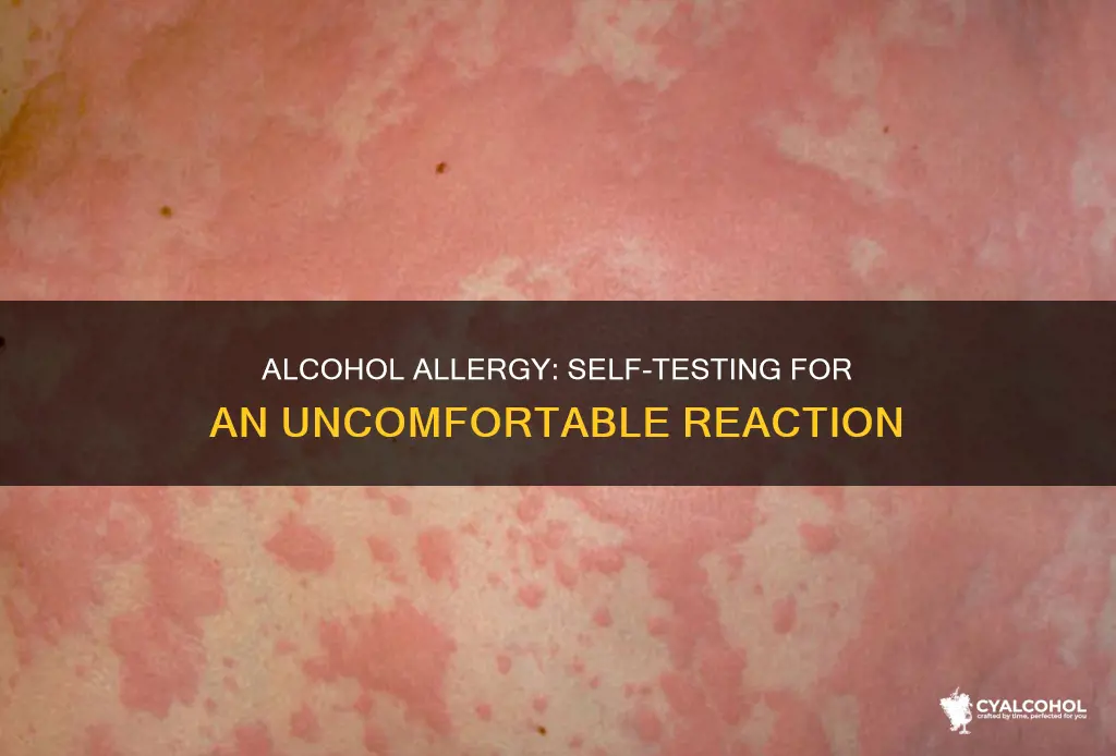 how to check if you are allergic to alcohol