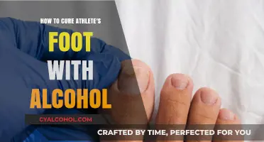 Alcohol Treatment for Athlete's Foot: Does it Work?