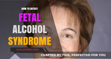 Identifying Fetal Alcohol Syndrome: Key Signs and Diagnostic Approaches