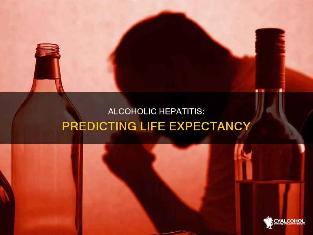 how to determine life expectancy with acute alcoholic hepatitis