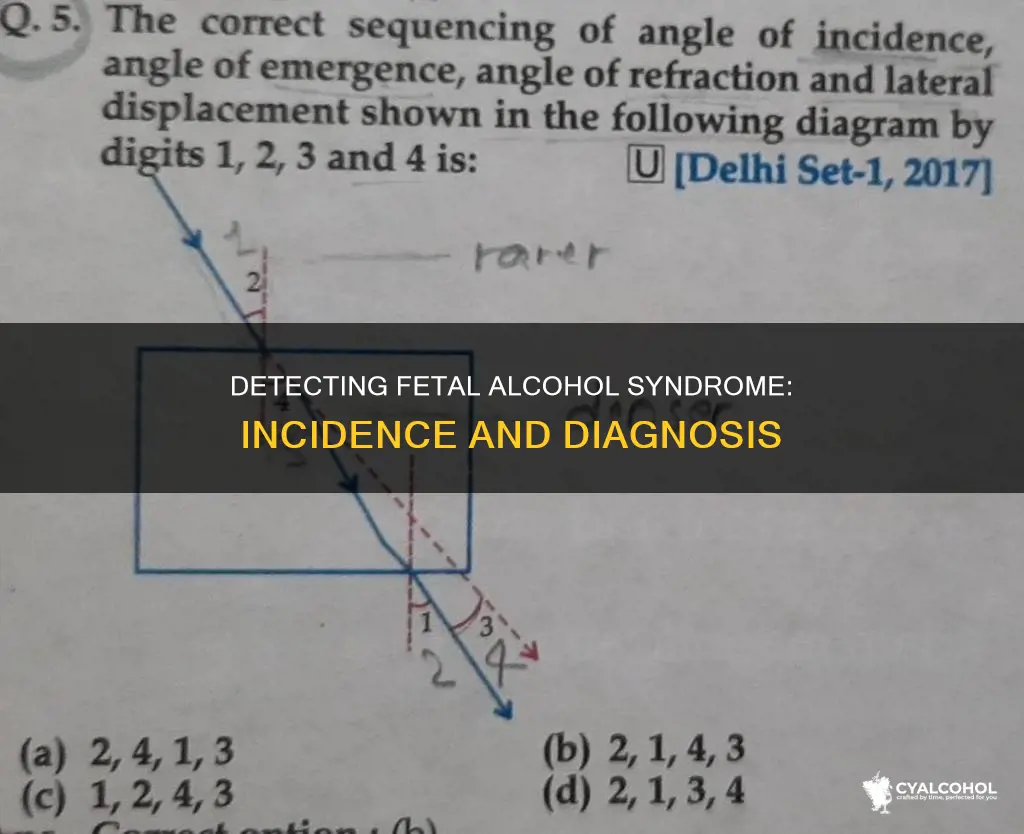 how to determine the incidence of fetal alcohol syndrome