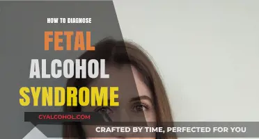Identifying Fetal Alcohol Syndrome: Key Diagnostic Steps and Indicators