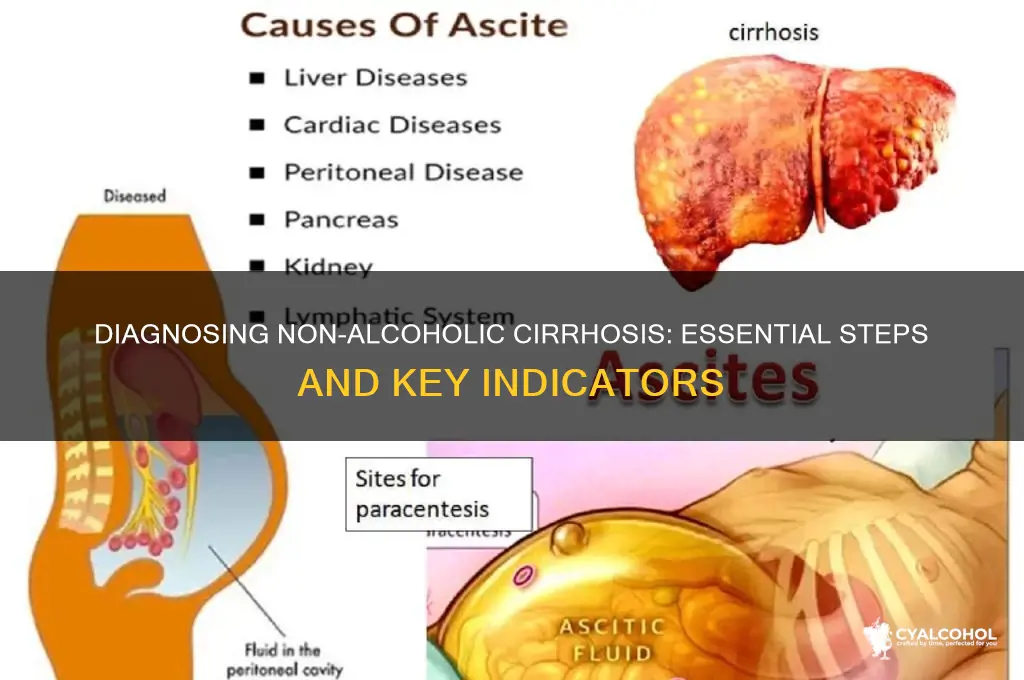 how to diagnose non alcoholic cirrhosis