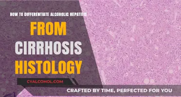 Alcoholic Hepatitis vs Cirrhosis: A Histological Perspective
