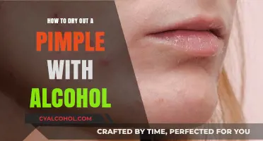 Drying Pimples: Alcohol Method
