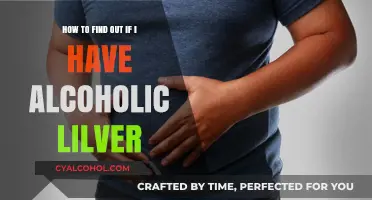 Signs and Symptoms of Alcoholic Liver Disease