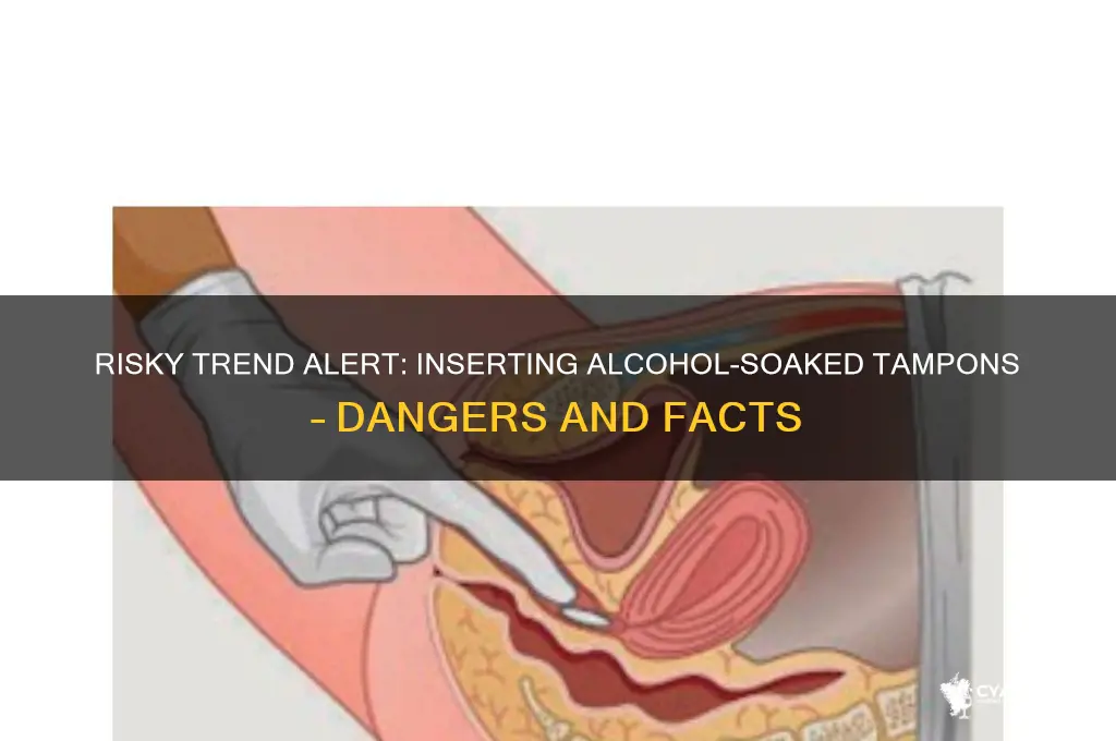 how to insert alcohol-soaked tampons
